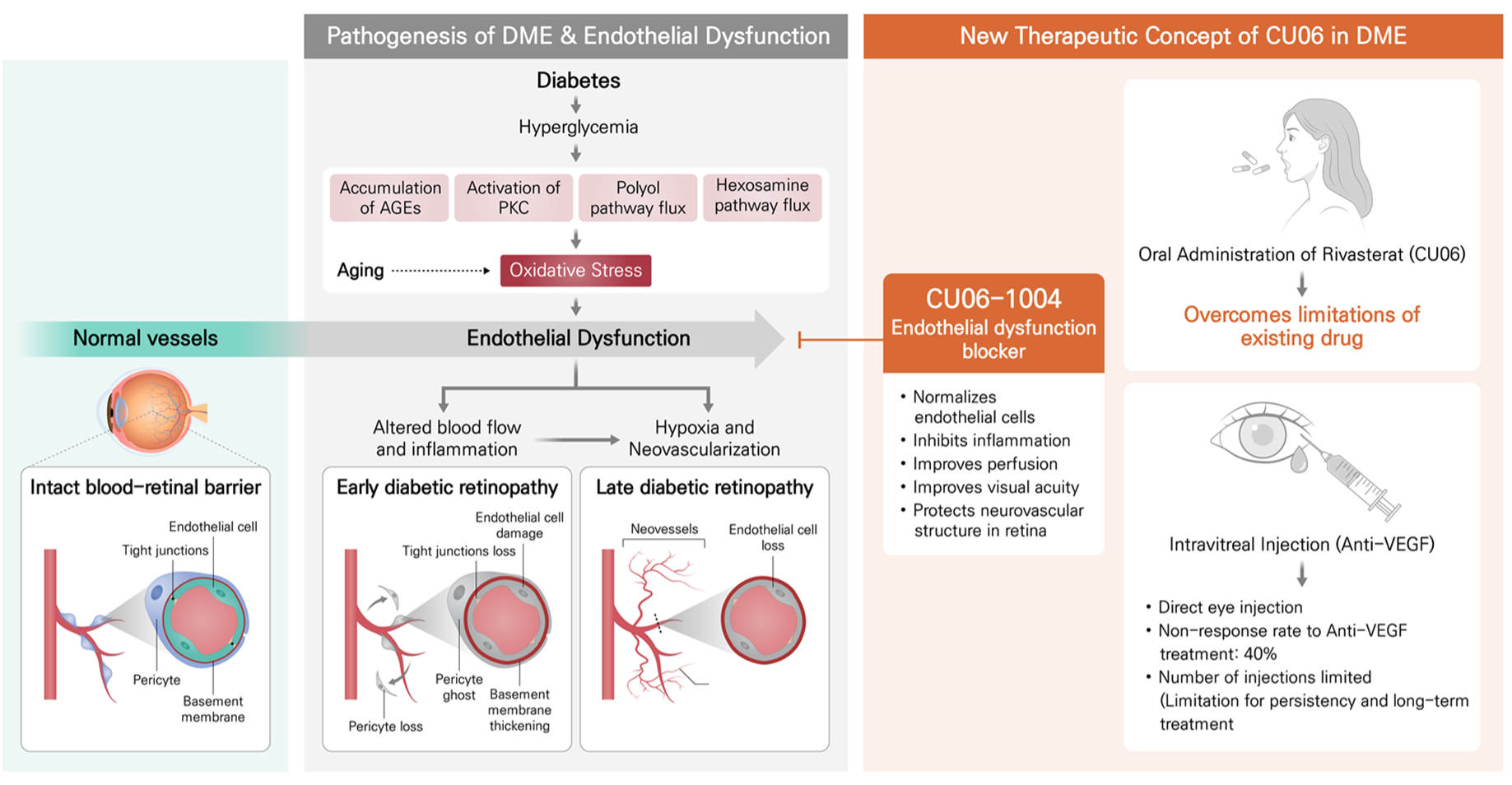 Therapeutic Funtion of Rivasterat in Diabetic Macular Edema